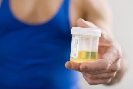 Should Schools Perform Drug Tests on Students? Should Schools Perform Drug Tests on Students?